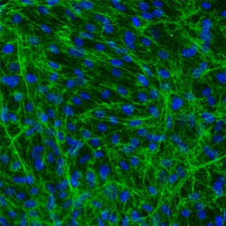 Human Bladder Stromal Fibroblasts