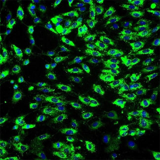 Human Bladder Microvascular Endothelial Cells