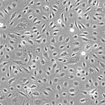 Human Bladder Microvascular Endothelial Cells