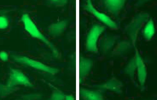 Green Fluorescent MDA-MB-231 Cell Line