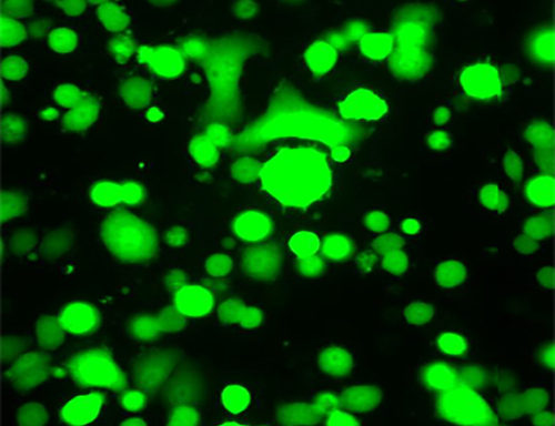 Green Fluorescent SK-Br-3 Cell Line