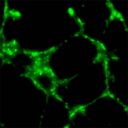 Green Fluorescent Primary HUVEC