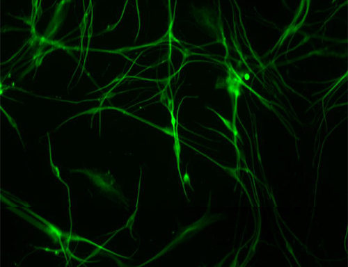 Green Fluorescent Primary Dorsal Root Ganglion Cells
