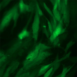 Green Fluorescent Primary Human Dermal Fibroblasts