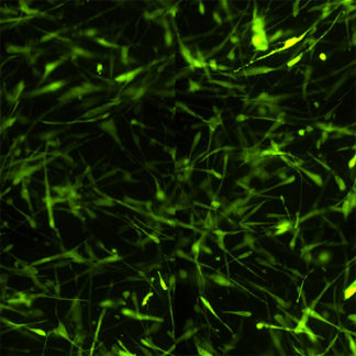 Fluorescent Primary Human Hepatic Stellate Cells