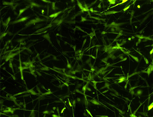 Green Fluorescent Human Hepatic Stellate Cells