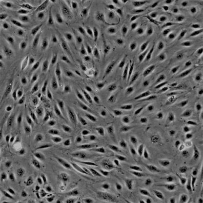 Fluorescent Primary Human Brain Microvascular Endothelial Cells