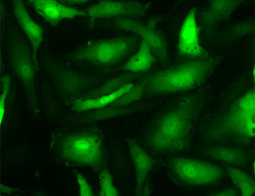 Green Fluorescent Primary Human Brain Microvascular Endothelial Cells