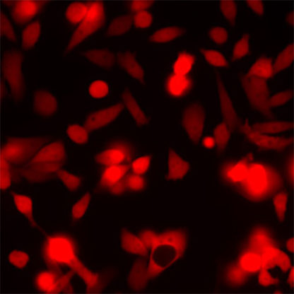 Red Fluorescent PC-3 Cell Line