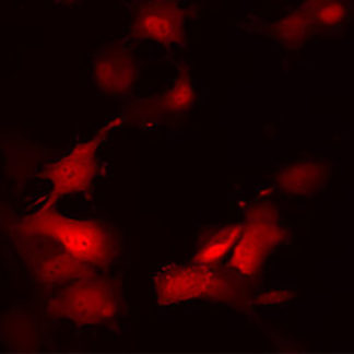 Red Fluorescent B16-F10 Cell line