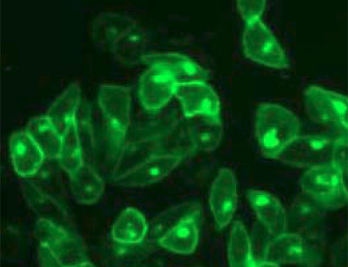Fluorescent Cannabinoid 2 Receptor Internalization Assay Cell Line