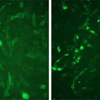 Fluorescent Bradikinin Receptor 2