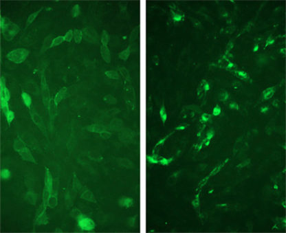 Fluorescent Bradikinin Receptor 2