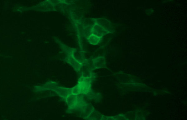 Fluorescent Dopaminergic Receptor D1 Internalization Assay Cell Line