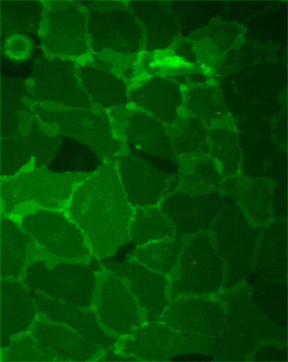 Fluorescent Opioid Receptor, Kappa 1 Internalization Assay Cell Line