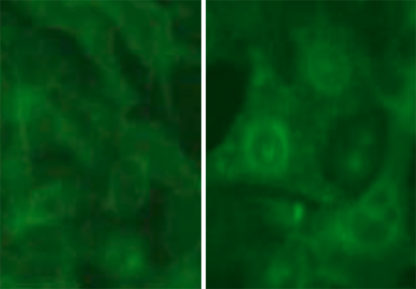 Fluorescent Calcitonin Receptor Internalization Assay Cell Line