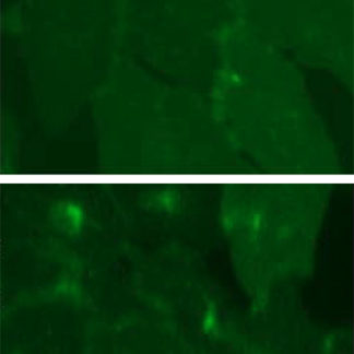 Fluorescent Somatostatin Receptor Type 2 Internalization Assay cell line