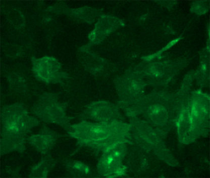 Fluorescent Human Chemokine (C-C motif) receptor 2 (CCR2) complex Internalization Assay Cell Line
