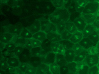 Fluorescent human chemokine (C-X-C motif) receptor 2 Internalization Assay Cell Line