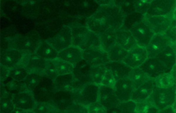 Fluorescent human chemokine (C-X-C motif) receptor 2 Internalization Assay Cell Line