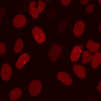 Nuclear Apoptosis Assay Cell Lines (LMNB1)