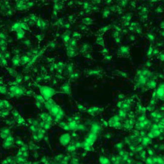 HEK293 cell line stable expressing Green Fluorescent BACE1