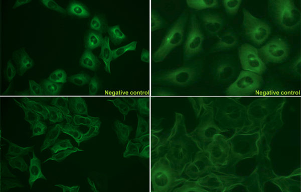 Alzheimer’s Disease (AD) Model: Tau Phosphorylation Assay Cell Line