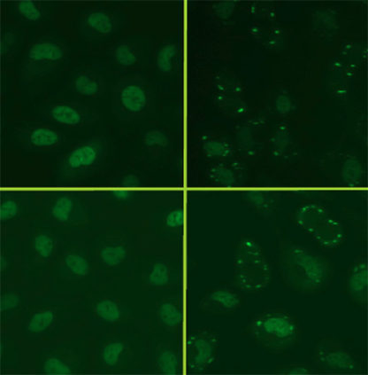 Amyotrophic Lateral Sclerosis (ALS) Model: FUS/TLS Stess Granuels Assay Cell Line