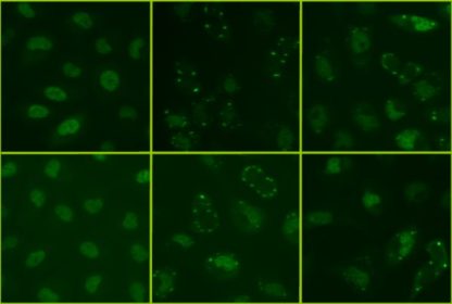 Amyotrophic Lateral Sclerosis (ALS) Model: FUS/TLS Stess Granuels Assay Cell Line