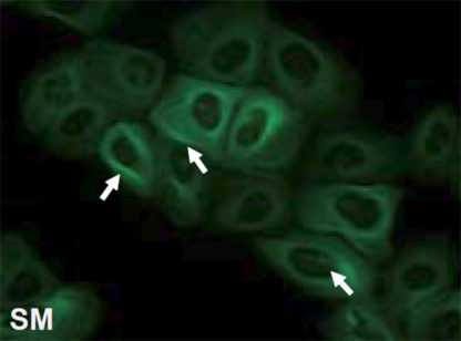 Cell lines (SH-SY5Y or HEK293) expressing different fluorescent tau proteins and mutants