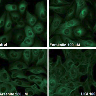 Cell lines (SH-SY5Y or HEK293) expressing different fluorescent tau proteins and mutants