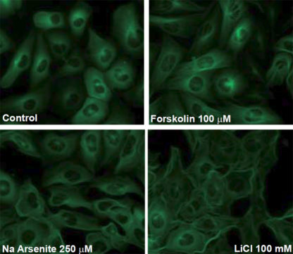 Cell lines (SH-SY5Y or HEK293) expressing different fluorescent tau proteins and mutants