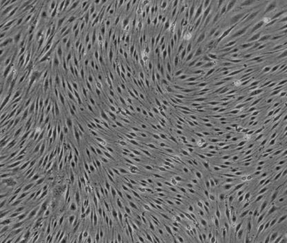 Rat Aortic Endothelial cells