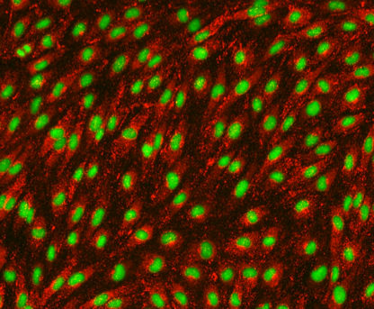 Rat Aortic Endothelial cells