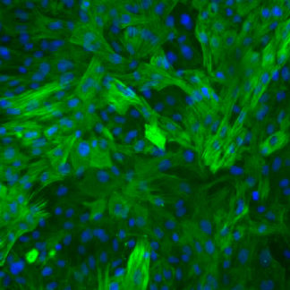 Rat Aortic Smooth Muscle cells