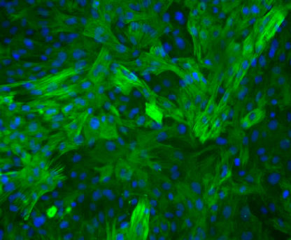 Rat Aortic Smooth Muscle cells