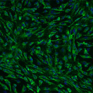Rat Cardiac Microvascular Endothelial cells