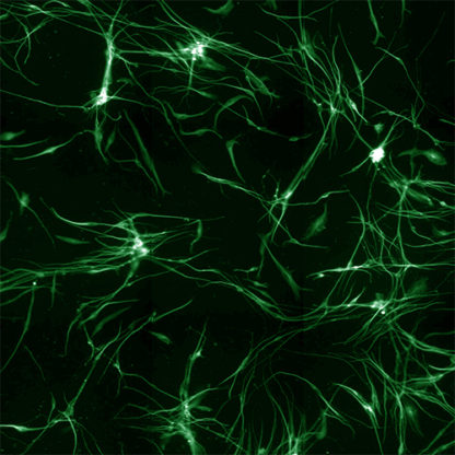 Rat Dorsal Root Ganglion Neurons