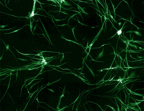 Rat Dorsal Root Ganglion Neurons
