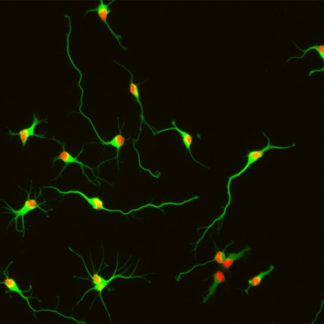 Rat Hippocampal Neurons