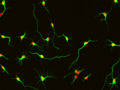 Rat Hippocampal Neurons