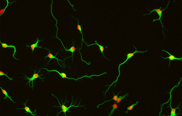 Rat Neurons – hippocampal
