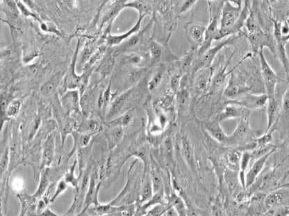 Rat Pulmonary Fibroblasts