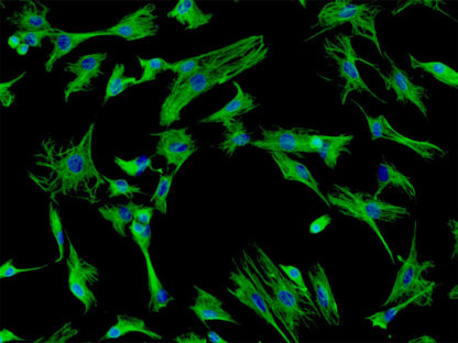 Rat Pulmonary Fibroblasts