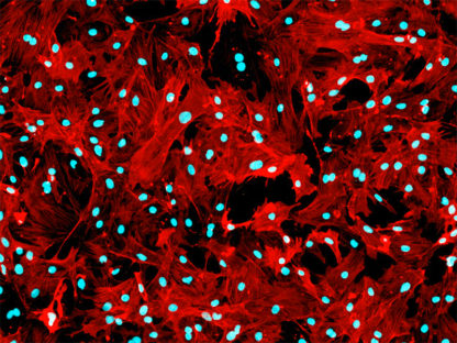 Rat Renal Mesangial Cells