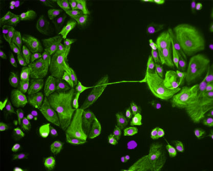 Rat Renal Proximal Tubular Epithelial Cells