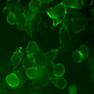 Cell Line stable expressing SARS-CoV Spike