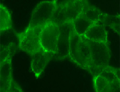 SARS-CoV-2 Spike Protein Mutant (V367F) Cell Line