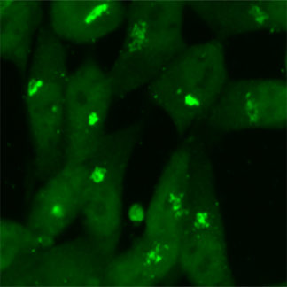 sars-cov-2 m protein