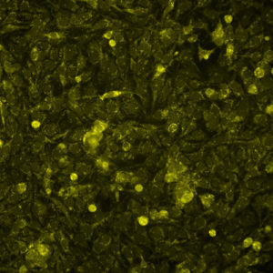 Immortalized Human Corneal Endothelial Cells – Cells Online